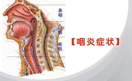 慢性咽炎的症状有哪些