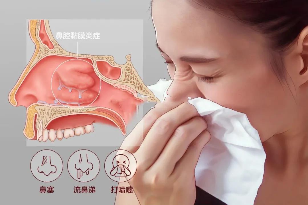 鼻炎的有效治疗方法